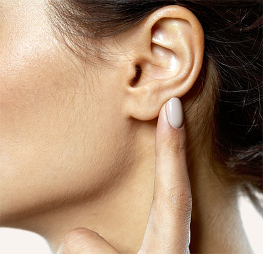 Otoplasty-02
